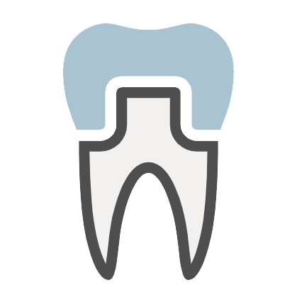 Dental Implant Process